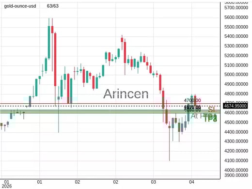 XAUUSD@4635.66 Chart